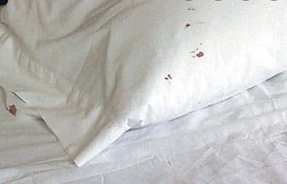 Early Sign of Bed Bugs